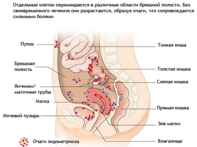 Kéo bụng dưới và đau tức ngực - nguyên nhân, bệnh lý có thể xảy ra